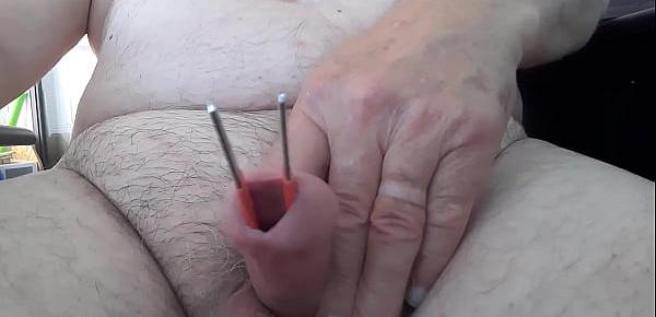  Tweezers in urethra stretching.